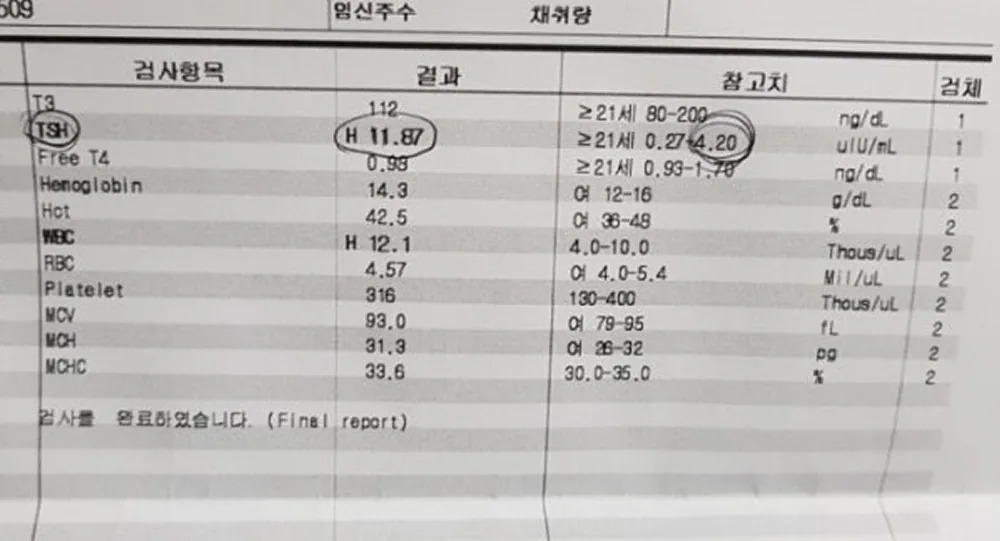 강*우 review media