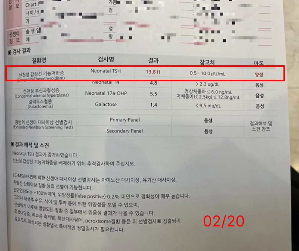 이*수 review media