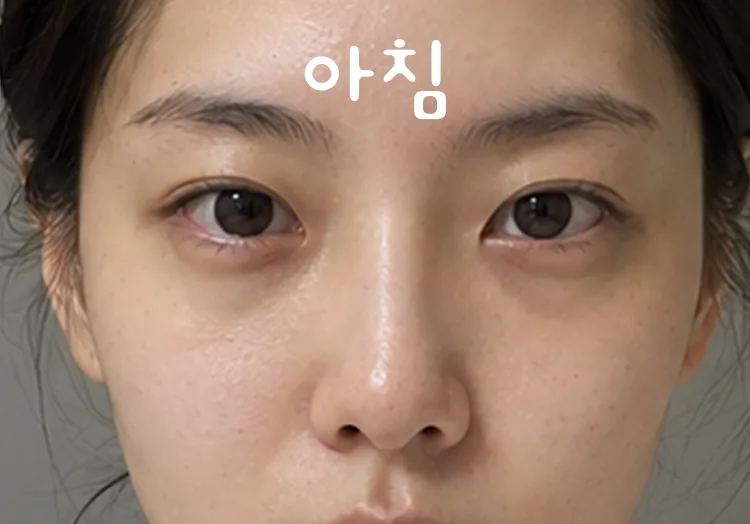 티어필 다이렉트 필름