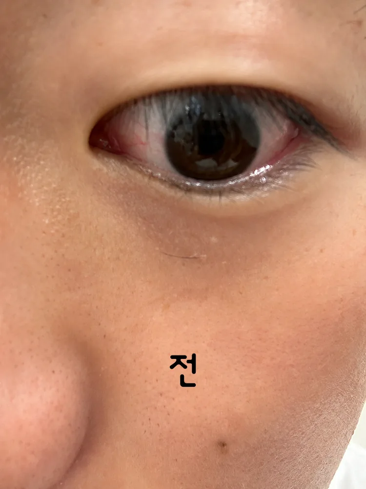 티어필 다이렉트 필름