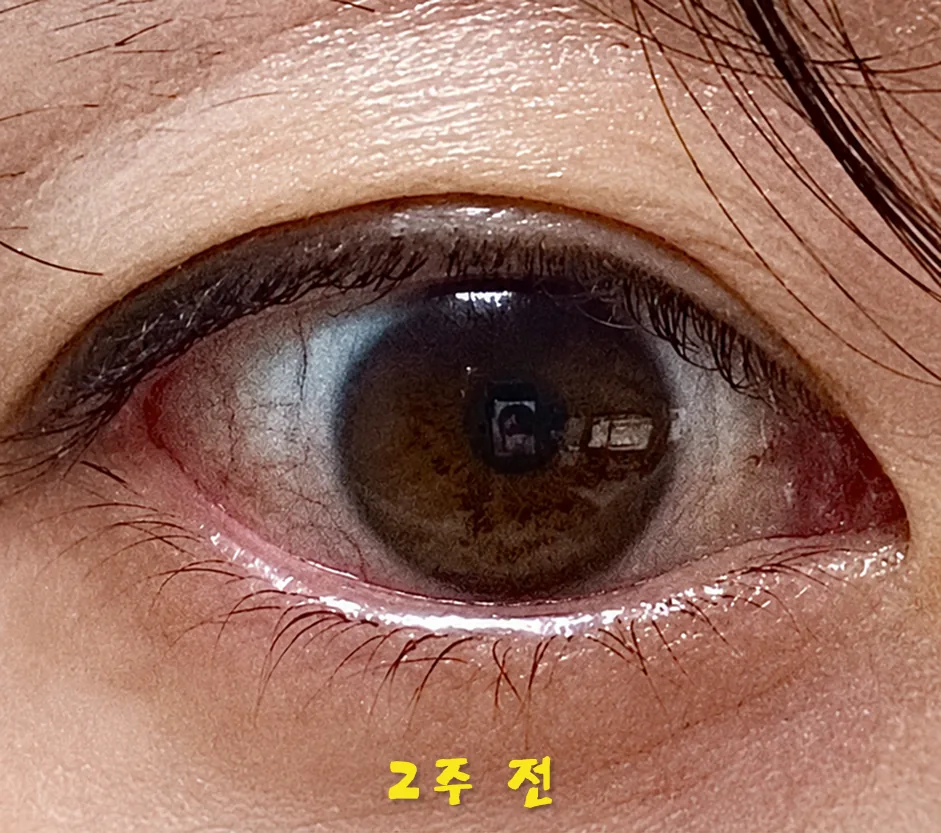 김*은 review media