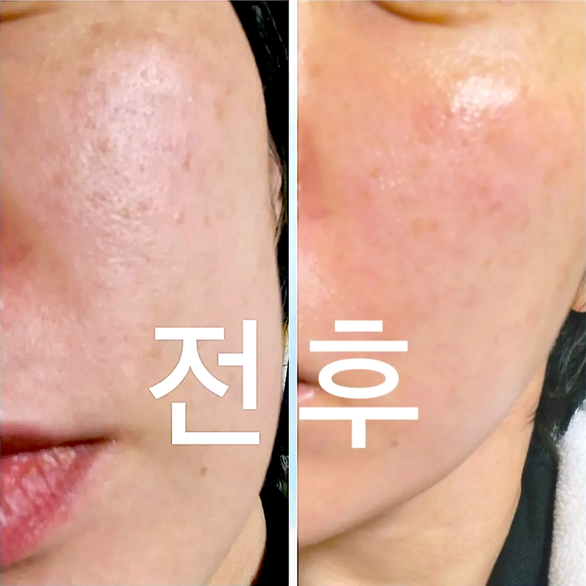 김*진 review media