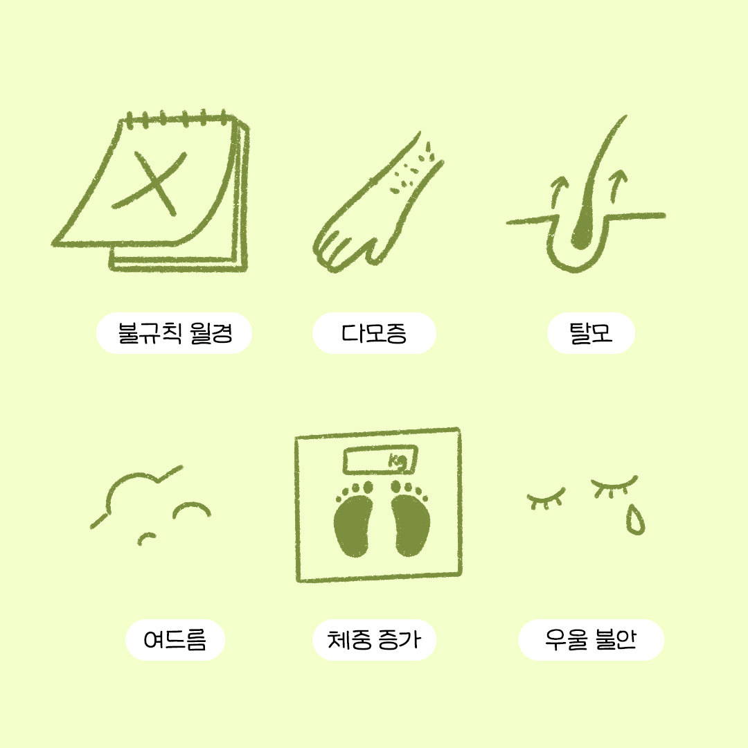 불규칙 월경, 다모증, 탈모, 여드름, 체중증가, 우울 불안의 증상들을 나열. 이는 다낭성 난소 증후군의 증상