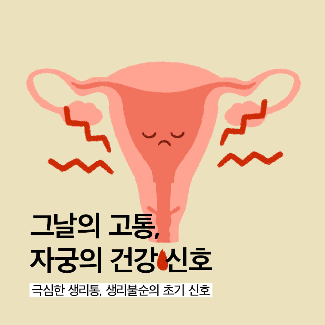 그날의 아픔, ‘생리통’ 지속되면 ‘생리불순’ 의심해보세요