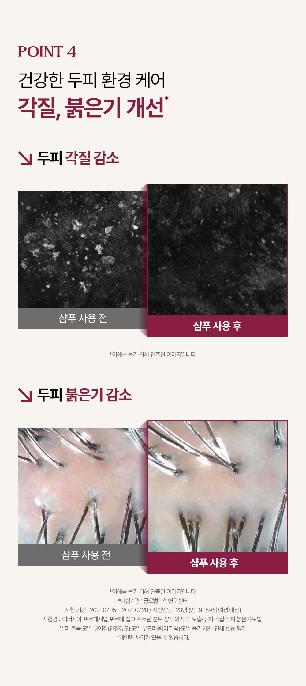 거미실크 단백질 탈모 샴푸