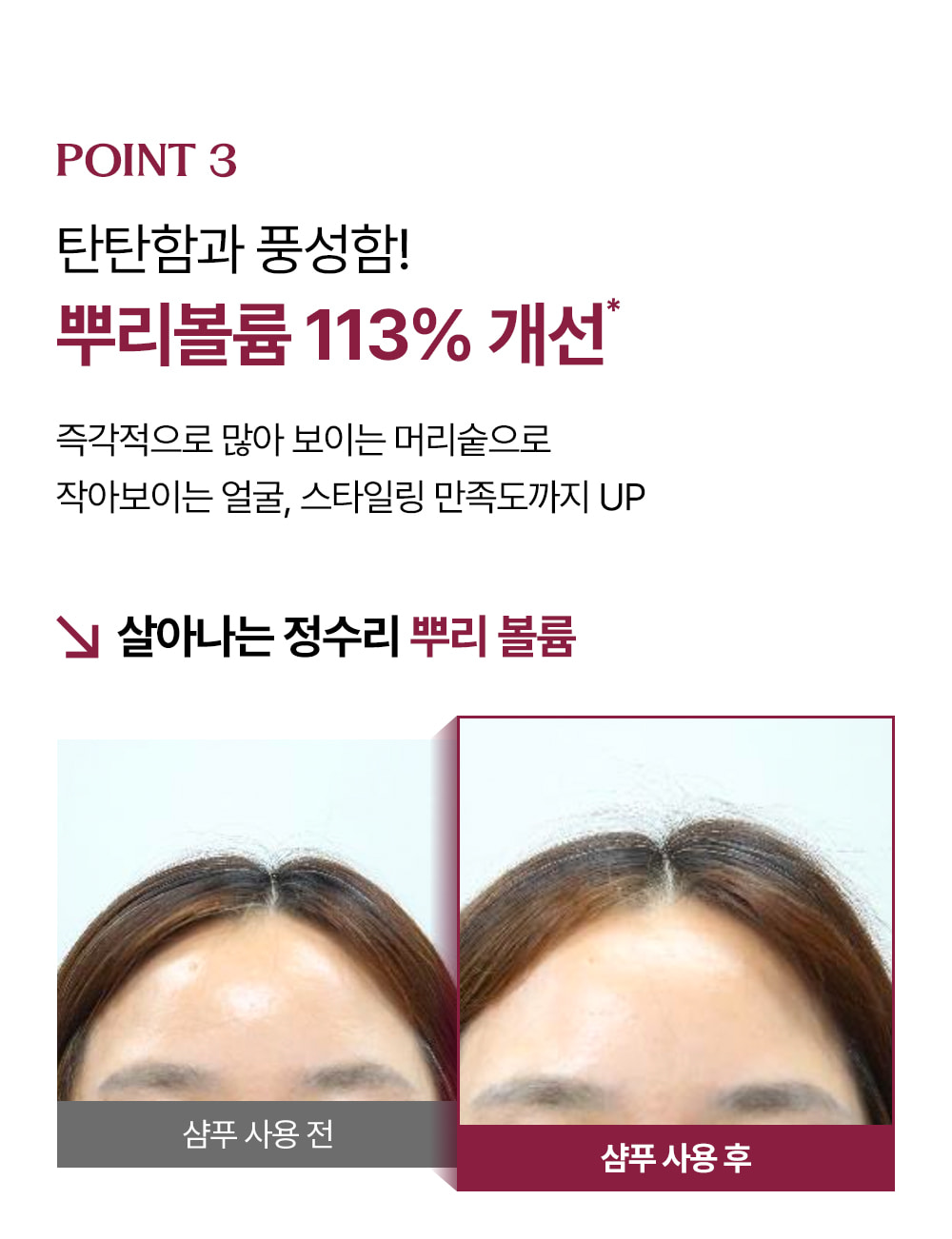 거미실크 단백질 탈모 샴푸