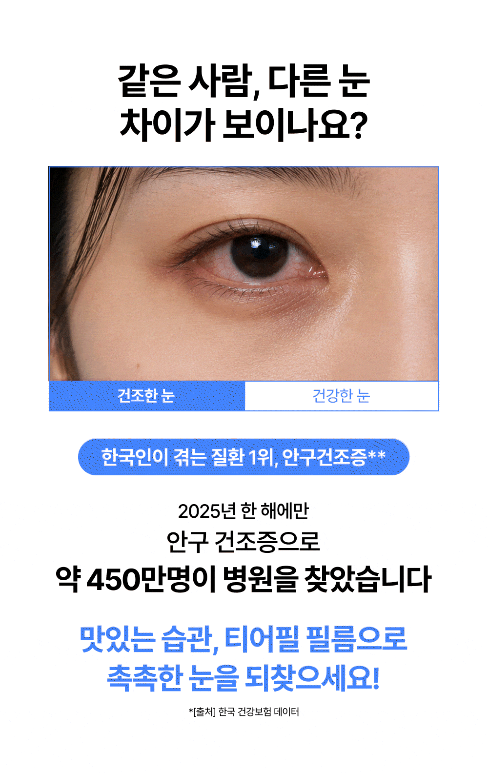 티어필 다이렉트 필름